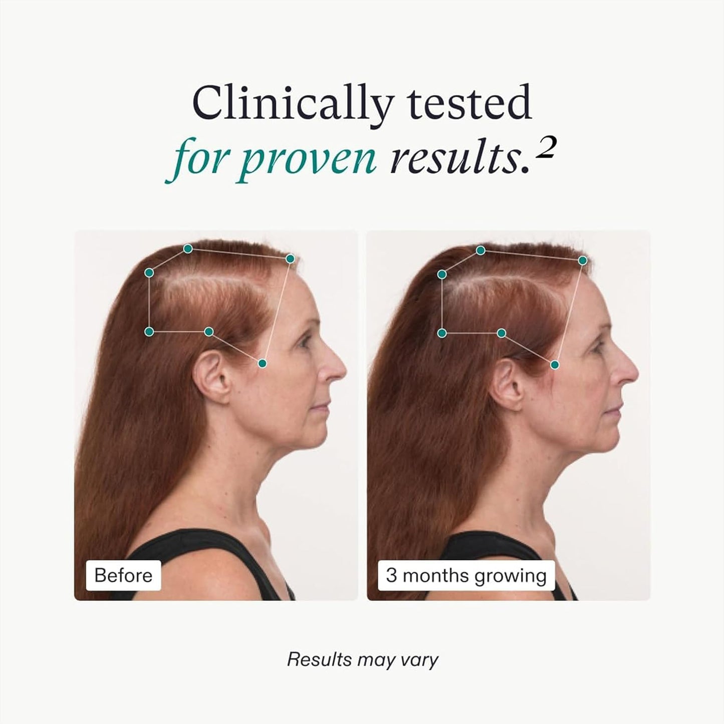 Women's Balance Hair Growth